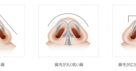 鼻を触りすぎると団子鼻や大きくなるって本当！？軟骨が変形する根拠 | Pixls [ピクルス]