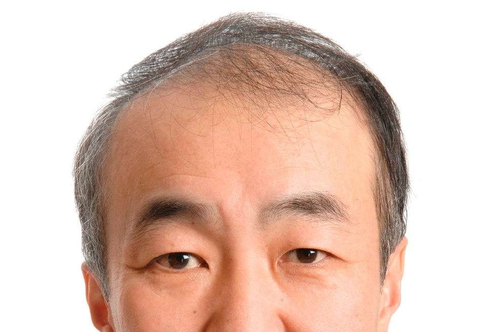 マッシュルームカットにしたい!