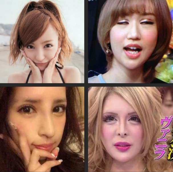 あきらかに！整形失敗…と思う芸能人をズバリ！！