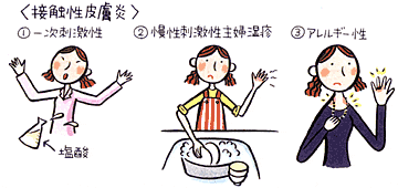 主婦湿疹（手湿疹）がつらい！！！
