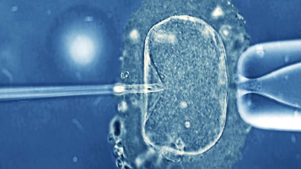 生殖補助治療を受けた男性の息子　同じ問題を受け継ぐ可能性 （BBC News） - Yahoo!ニュース