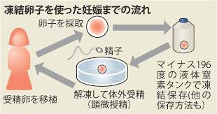 卵子を凍結保存した女性、凍結後パートナーを見つけた例少ない「保存したことで安心してしまう」