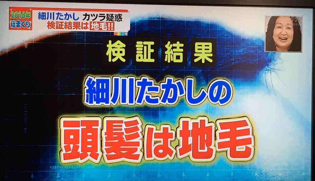 細川たかし、CCDカメラでカツラ疑惑完全払拭　ミヤネ屋で地毛認定