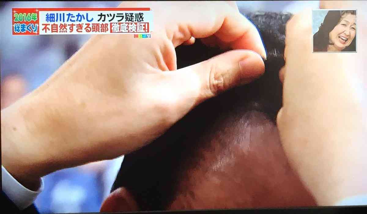 細川たかし、CCDカメラでカツラ疑惑完全払拭　ミヤネ屋で地毛認定