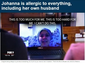 「人間アレルギー」の女性　「愛する夫に触れることもできない」（米）