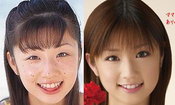 整形前の顔が好きだった芸能人