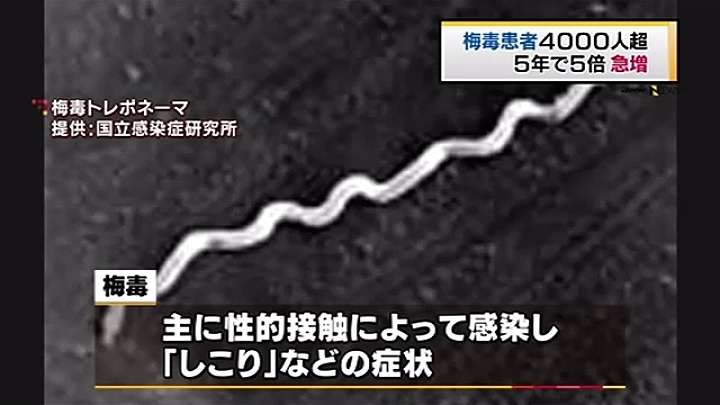 梅毒患者 今年4000人超、5年で5倍に急増