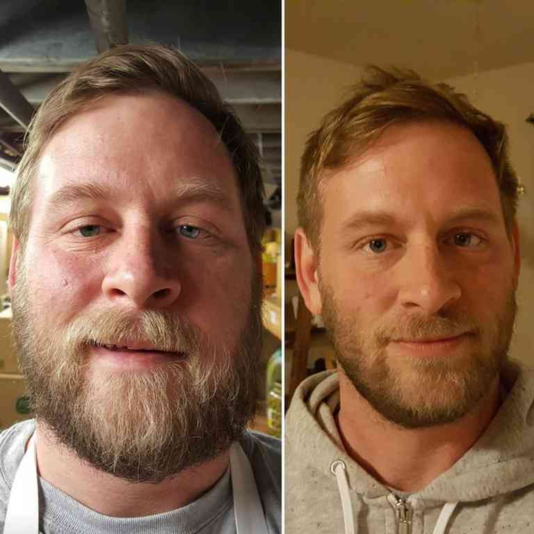 まるで別人みたい！「禁酒」した人々のビフォーアフター写真に驚きの変化あり
