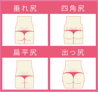 お尻の悩み