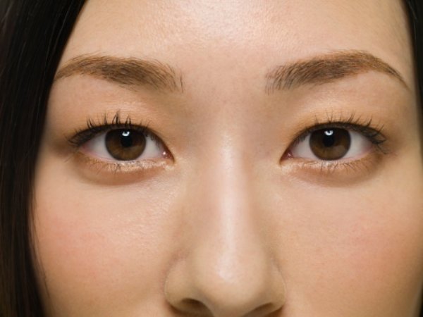 平行二重の目ってそんなにいいですか?