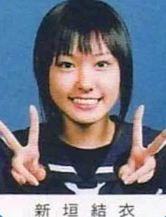 平行二重の目ってそんなにいいですか?