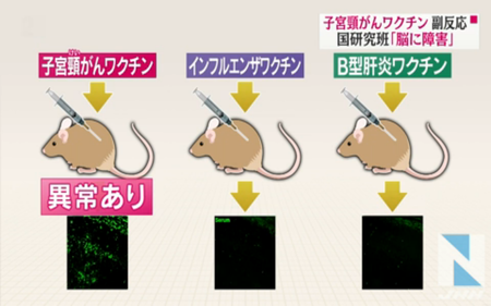 子宮頸がんワクチン研究班が捏造 厚労省、信州大は調査委設置を 利用される日本の科学報道（続篇）　WEDGE Infinity(ウェッジ)