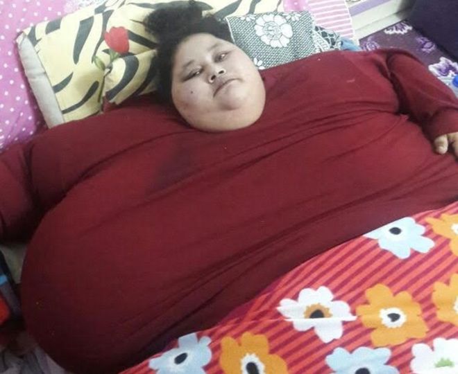 「体重500キロ」のエジプト女性、インドで手術へ