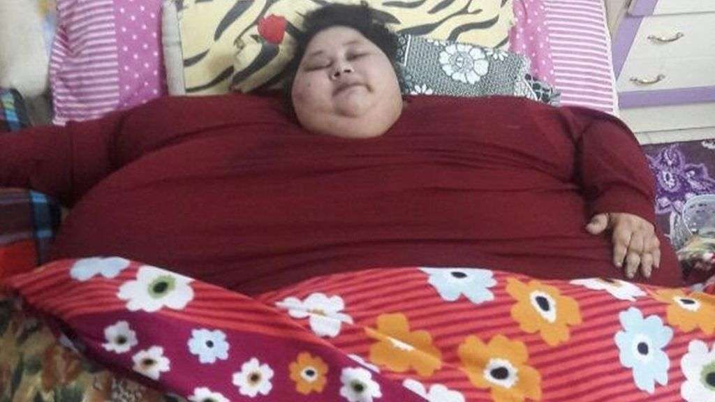 「体重500キロ」のエジプト女性、インドで手術へ - BBCニュース