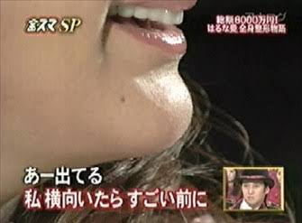 アゴに違和感を感じる芸能人