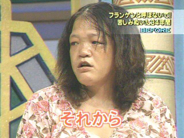 整形が成功する人と失敗する人の違い