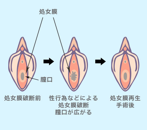 婦人科検診が苦手でも受けている方