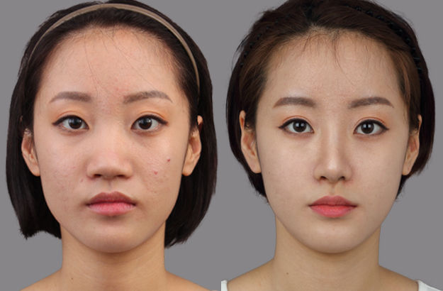 整形が成功する人と失敗する人の違い