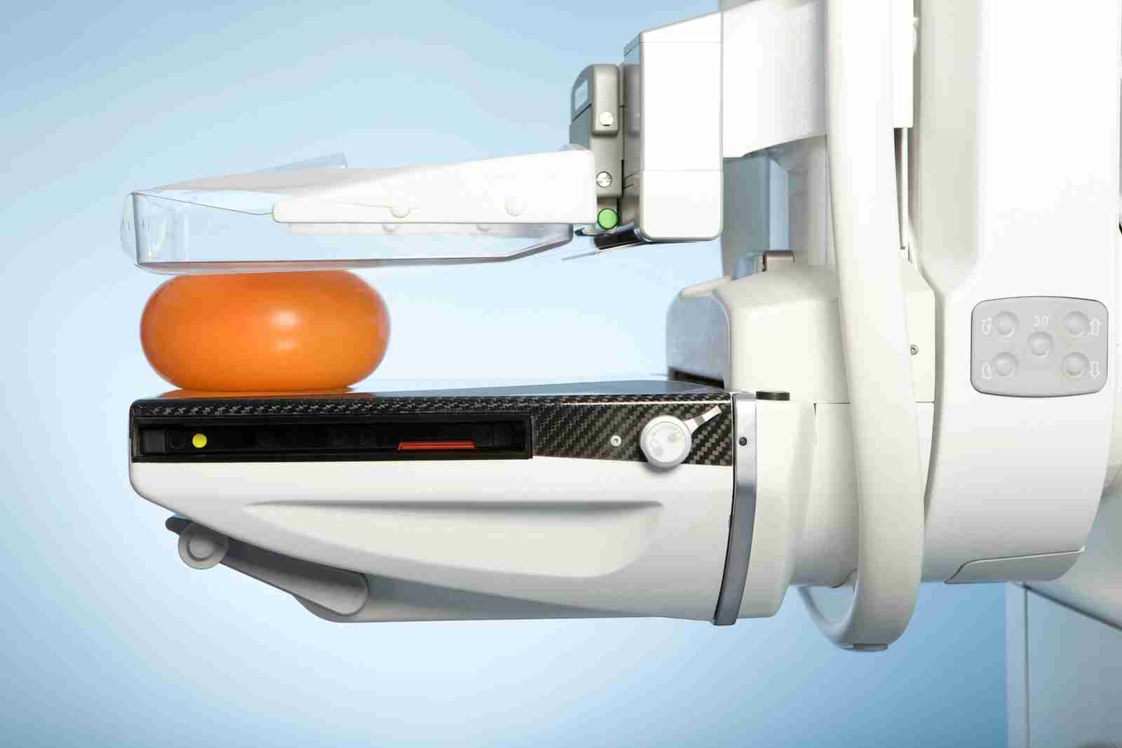 豊胸手術をすると乳がん検査ができない？→専門医「都市伝説。まったく問題ありません」
