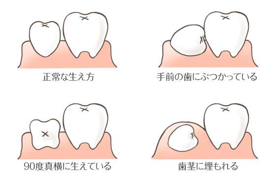 未来に期待したい人類の体の進化