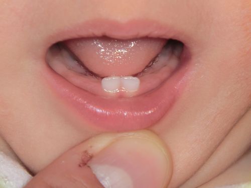 未来に期待したい人類の体の進化