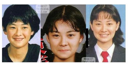 整形成功したと思う芸能人