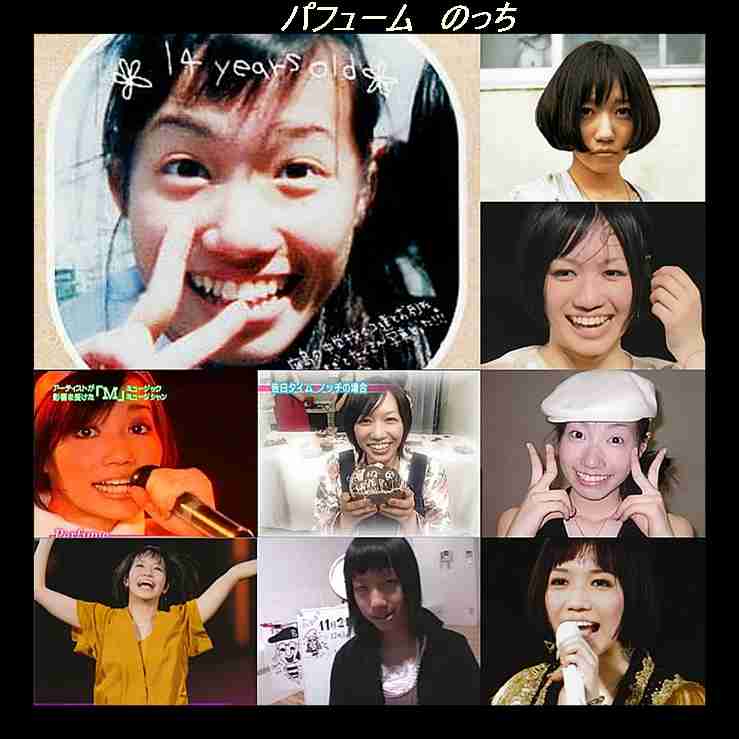 整形成功したと思う芸能人