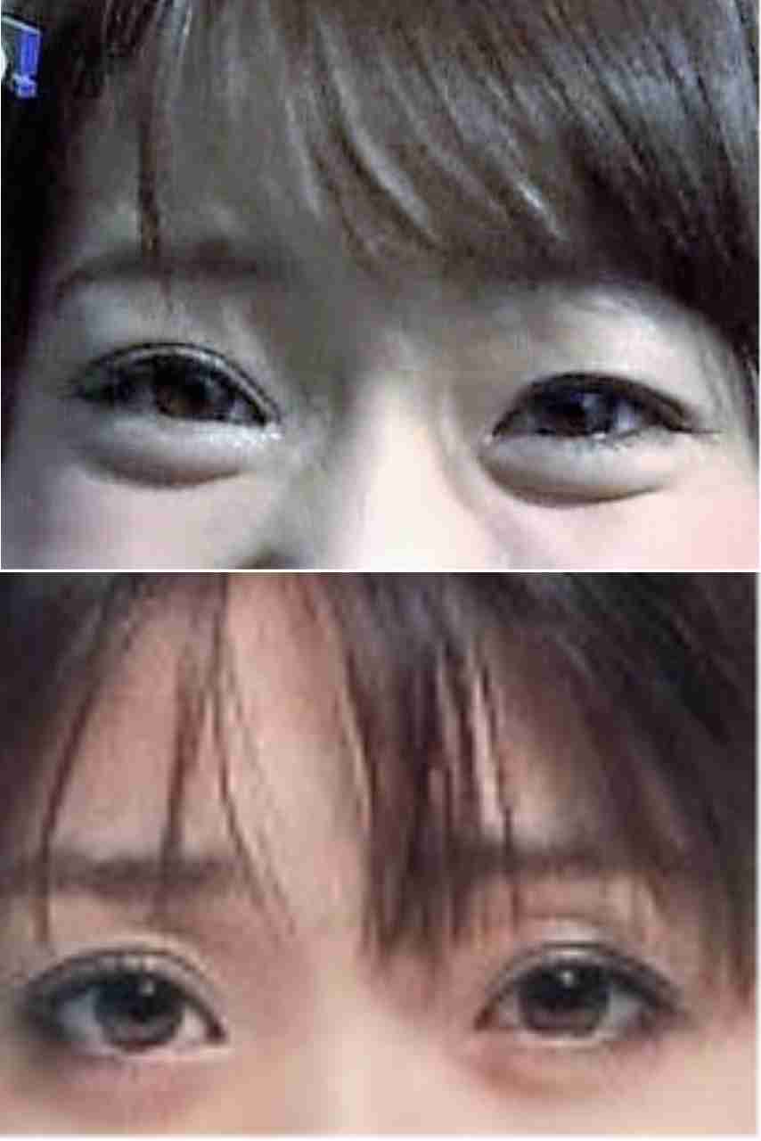 整形成功したと思う芸能人