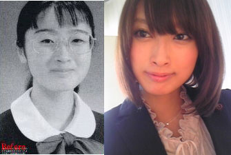 整形成功したと思う芸能人