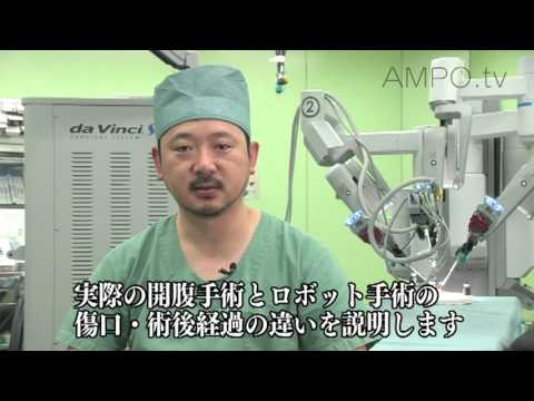 東京腎泌尿器センター大和病院 ＜ダヴィンチ＞ロボット手術 - YouTube