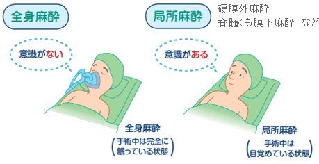 全身麻酔したことある人