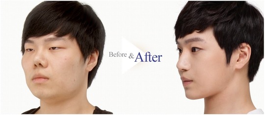 首相の妻・昭恵氏は私人？公人？　スタッフに公務員5人