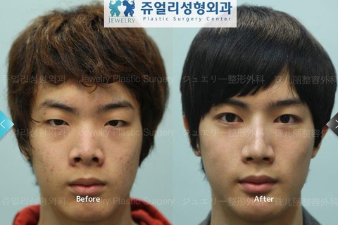 首相の妻・昭恵氏は私人？公人？　スタッフに公務員5人