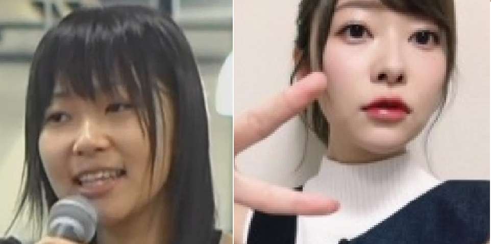 整形成功したと思う芸能人