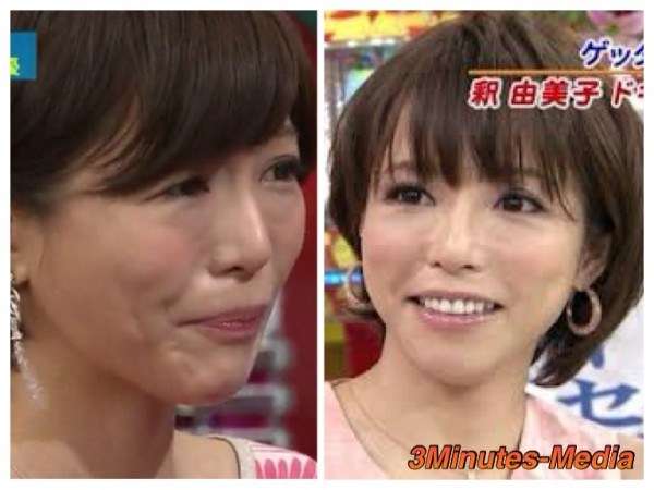 小さい頃と顔が激変した人と整形した人の差