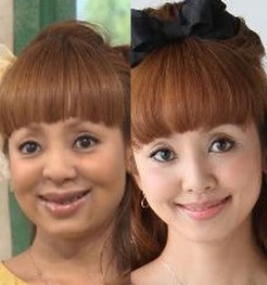 整形した人！  その後バレたりしましたか？