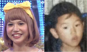  整形失敗した人！