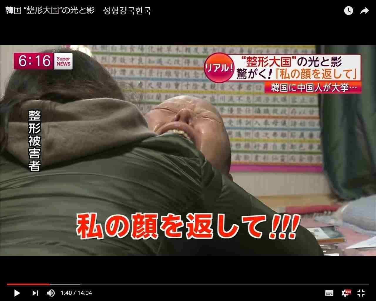 整形した人！  その後バレたりしましたか？