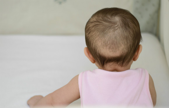 子供の円形脱毛症の原因はストレスではない！治療や対処法 | MARCH(マーチ)
