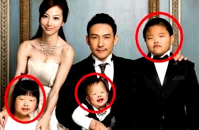 女「整形したいなぁ」バカ「親からもらった体を傷付ける気？」ワイ「いや」 :