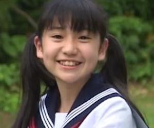 ほうれい線って消せる？
