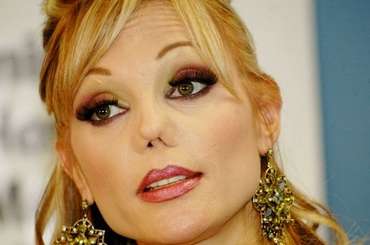 整形した人！  その後バレたりしましたか？