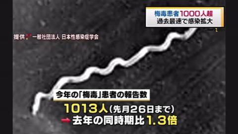 梅毒患者、はや1000人超え　昨年同期上回り、過去最速ペース