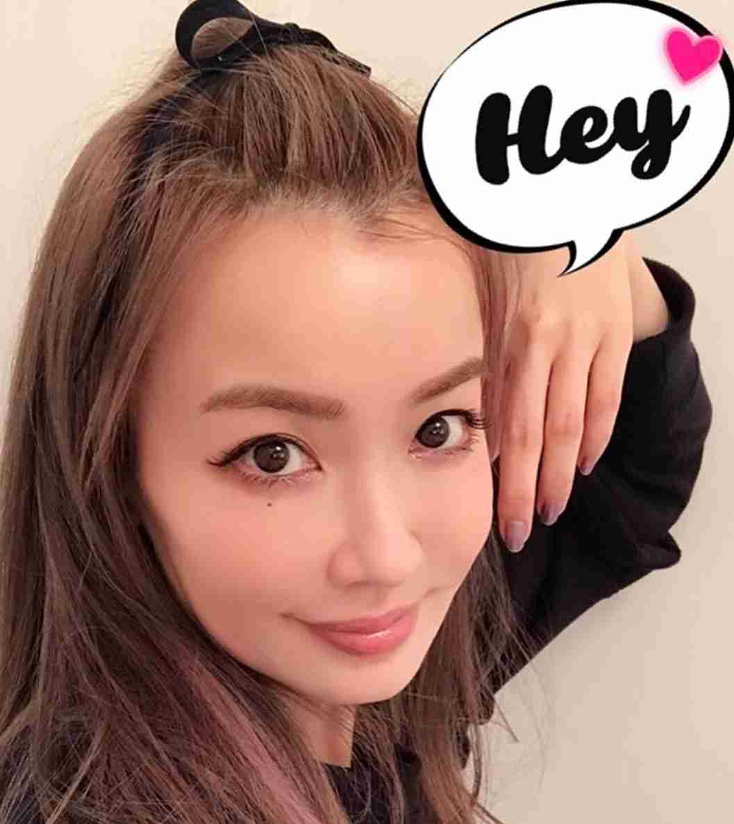 カイリー・ミノーグ、変わり果てた姿はボトックス中毒の結果と認める!