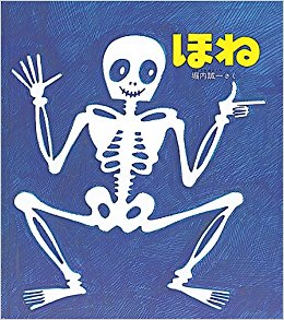 骨折したことある人！