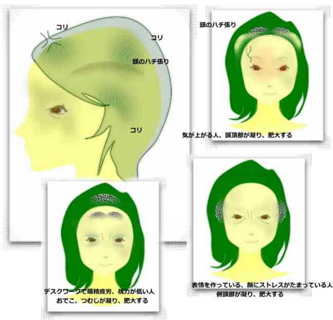 鉢張りさん大集合
