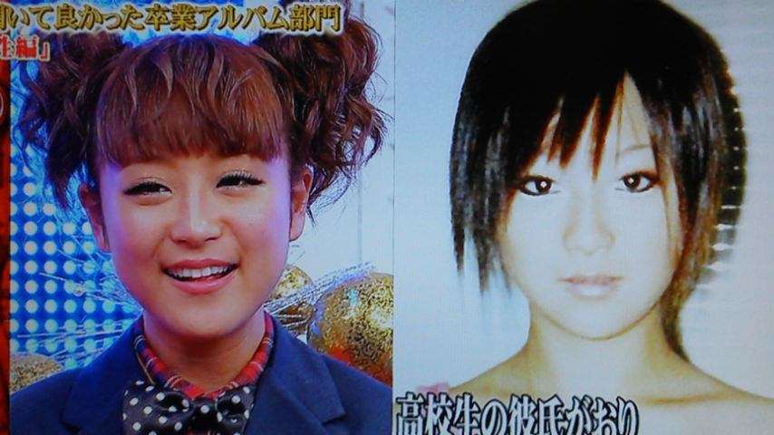 鈴木奈々、一重から二重に 比較写真を公開