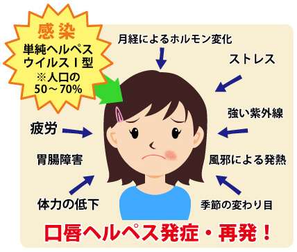 口唇ヘルペスで悩んでいる方
