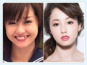 佐々木希が4位! 「美容整形でなりたい顔」の女性有名人の1位は?
