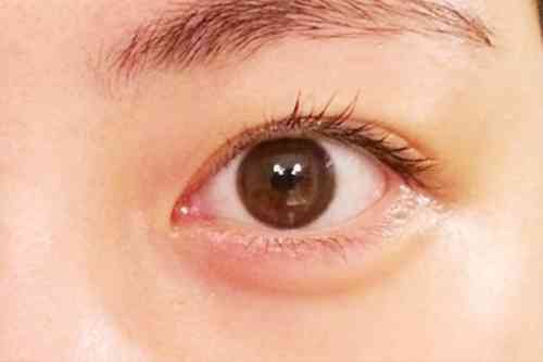 「眼球体操やブルーベリーが目にいい」はウソ!?目のジョーシキがくつがえる!